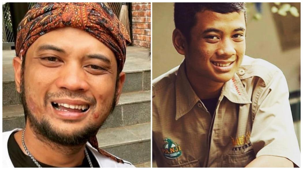 Kabar Terbaru Panji Petualang yang Sakit Diabetes, Tubuh Makin Kurus Gara-Gara Ini