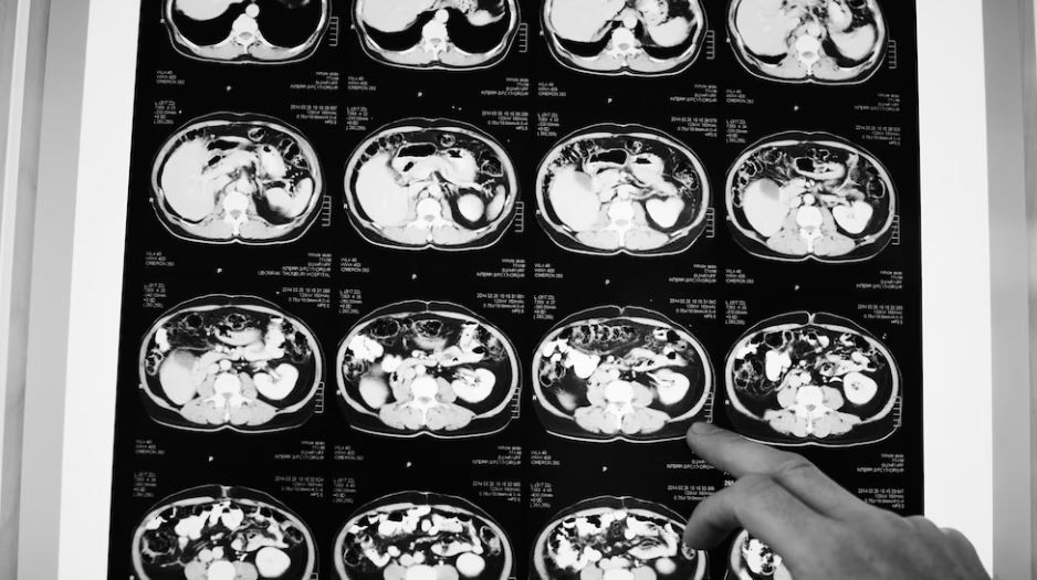 Mengenal Apa Itu Diffuse Axonal Injury, Efek yang Timbul dari Penganiayaan