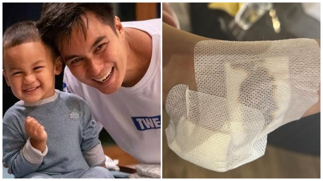 Baim Wong Bagikan Kabar Sedih, Kiano Tiger Wong Kena Musibah: Minta Doanya