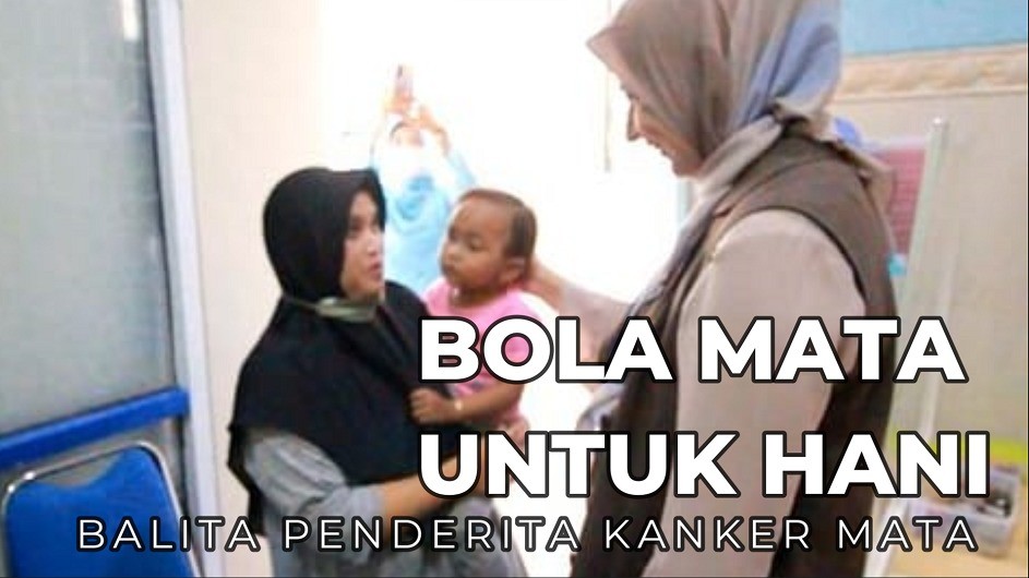 Bola Mata Palsu untuk Hani, Balita Penderita Kanker Netra di Jember