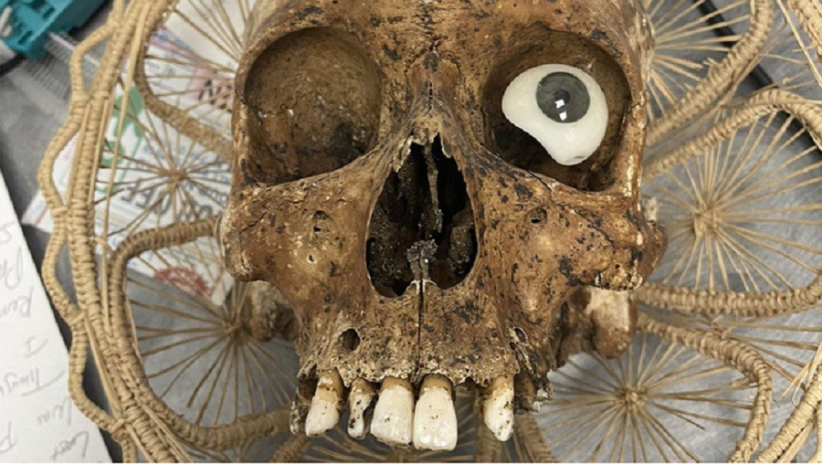 Ada Tengkorak Manusia dalam Kotak Sumbangan, Polisi Turun Tangan