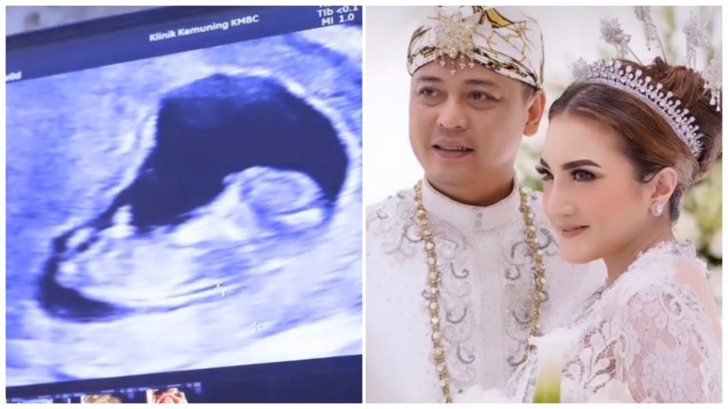 Kiki Amalia Hamil Anak Pertama di Usia 41 Tahun: Alhamdulillah, Doakan yang Terbaik