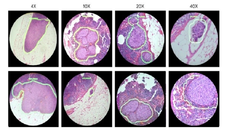 Google Garap Mikroskop Bertenaga AI, Bisa Bantu Dokter Mengenali Kanker