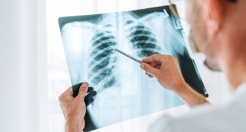 Orang Tua Wajib Tahu, Ini Cara Cegah dan Mengobati Pneumonia pada Anak