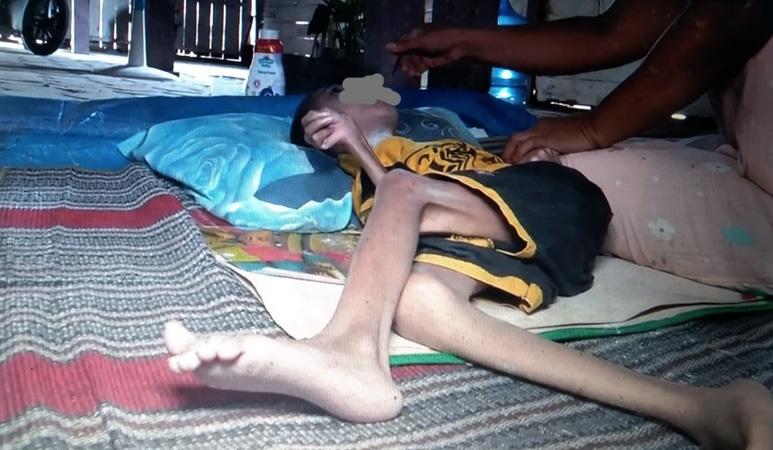 Pilu, Bocah 13 Tahun di Grobogan Terbaring Lumpuh selama 9 Tahun 