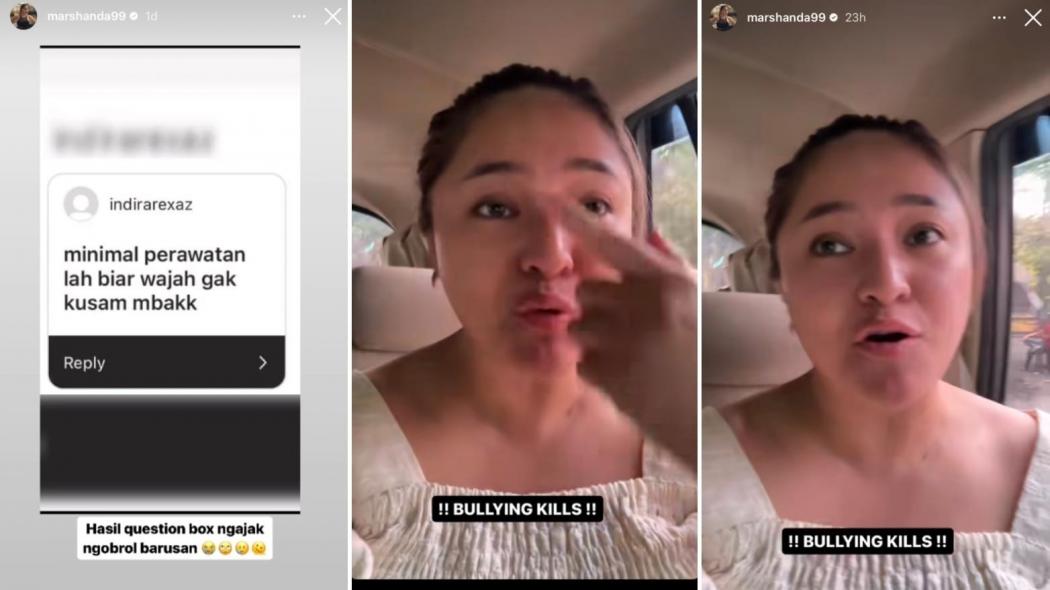 Dihina Wajahnya Tak Mulus, Begini Reaksi Marshanda: Emang Artis Harus Sempurna? 