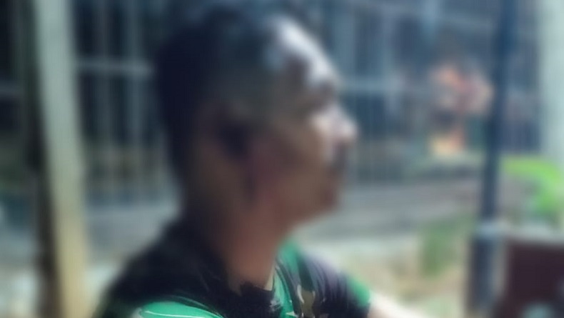 Kronologi Anggota TNI Dikeroyok 8 Orang di Pondok Ranggon Jaktim, Berawal dari Cekcok di Jalan