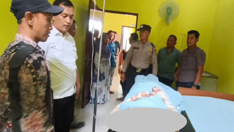 Kondisi Istri Dibakar Mantan Suami di Langkat, Wajah hingga Badan Luka Serius
