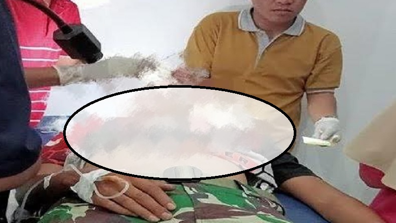 2 Anggota TNI Jadi Korban Pembacokan di Empat Lawang, 1 Terluka Parah