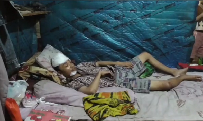 Remaja Sidoarjo Luka Parah Dikeroyok Sekelompok OTK, Keluarga Bingung Biaya Perawatan 