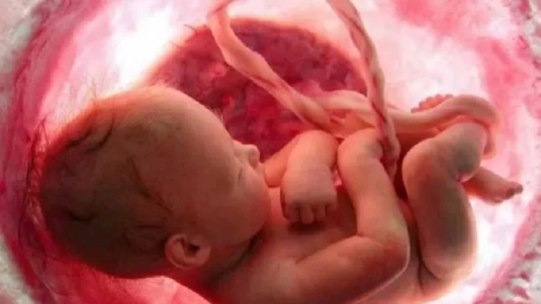 Apa Itu Fetus in Fetu? Kondisi yang Membuat Seorang Bayi Lelaki Bisa Hamil 