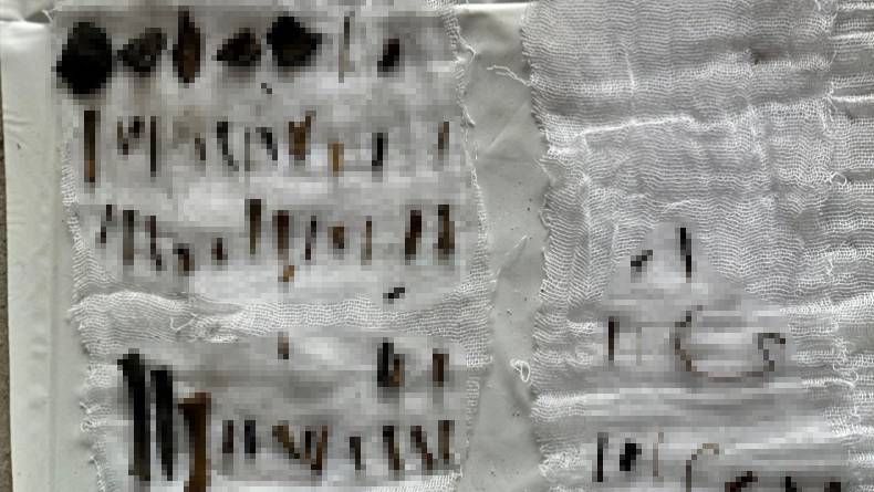 7 Kerangka Janin Ditemukan dalam Septic Tank Rumah Aborsi di Jaktim