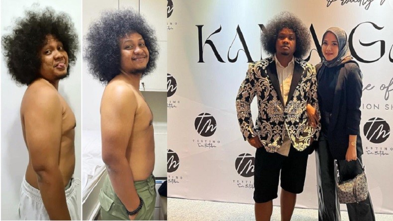 Gara-Gara Kena Diabetes, Babe Cabita Rela Menjauhi Makanan Ini