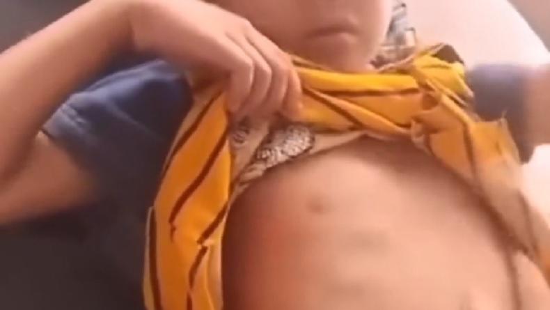 Viral Siswa SD di Minahasa Selatan Meninggal Dunia Diduga usai Disuntik Vaksin di Sekolah