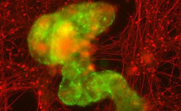 Ilmuwan Ciptakan Robot Biologis Berukuran Kecil dari Sel Manusia