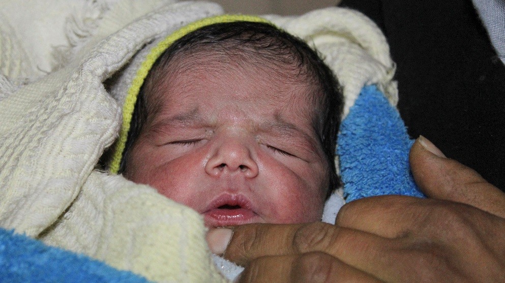 Kenapa Bayi dan Anak Kecil Gampang Biang Keringat? Ternyata Ini Penyebabnya