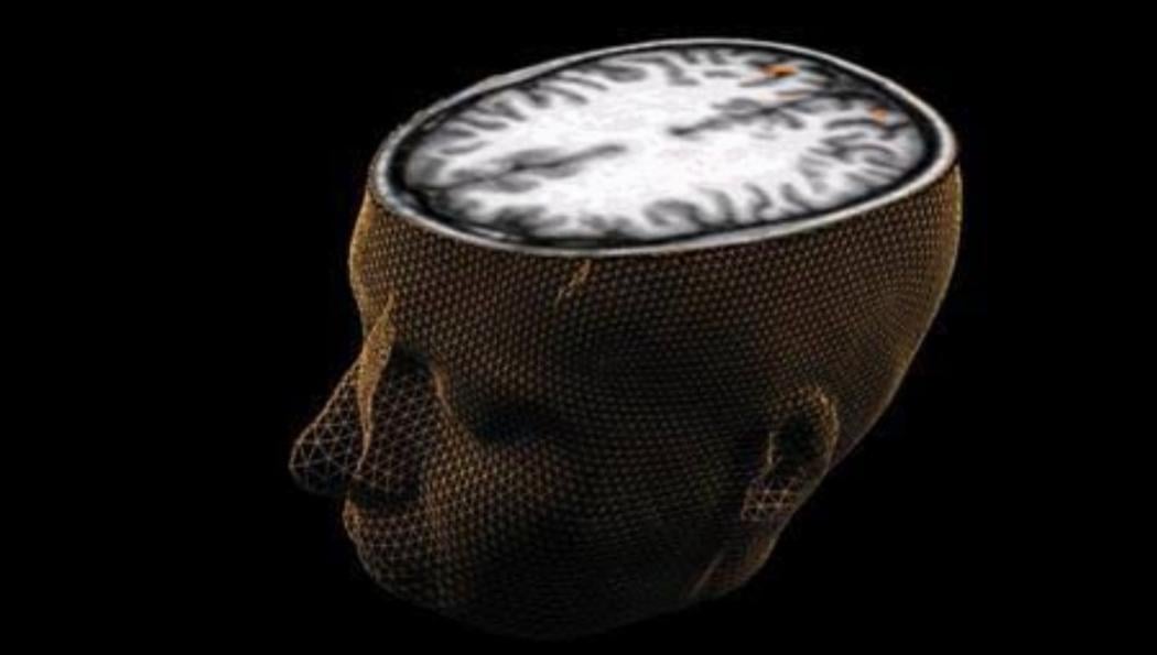 Ilmuwan Sisipkan Sel Otak Manusia pada Prosesor Komputer, Begini Hasilnya