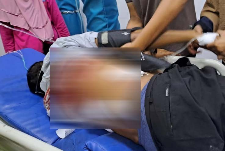 Tokoh Masyarakat di Sampang Ditembak OTK, Pelaku Pakai Masker dan Helm