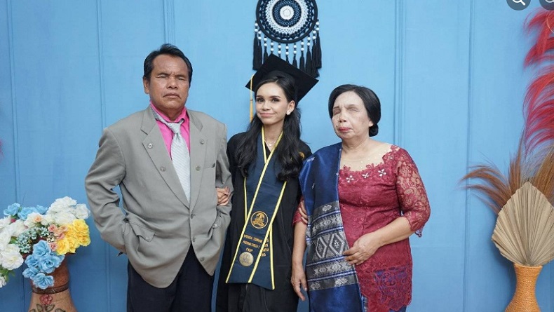 Kisah Inspiratif Septiana Mahasiswi Lulus Cumlaude, Bangga Lahir dari Ayah Ibu Tunanetra