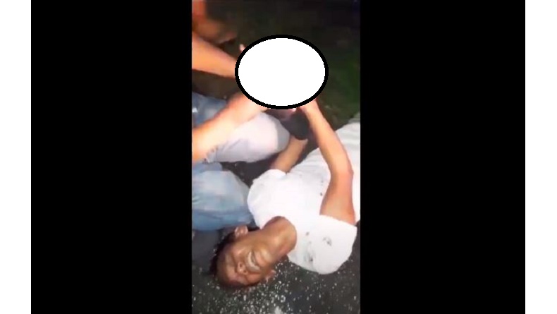 Ngeri, Tangan Pria di Luwu Hancur Terkena Ledakan Petasan saat Malam Tahun Baru