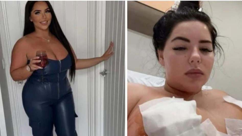 Ngeri Wanita Ini Sekarat Usai Jalani Operasi Implan Payudara