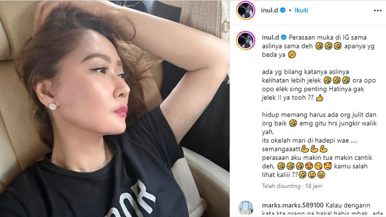 Diejek Netizen Wajahnya Jelek, Inul Daratista Beri Jawaban Menohok: Ora Opo-Opo Elek 
