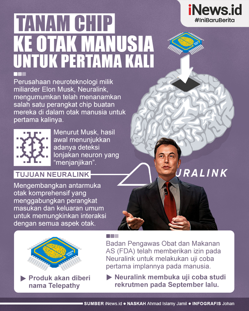 Infografis Perusahaan Elon Musk Neuralink Tanam Chip ke Otak Manusia, Pertama Kali di Dunia!