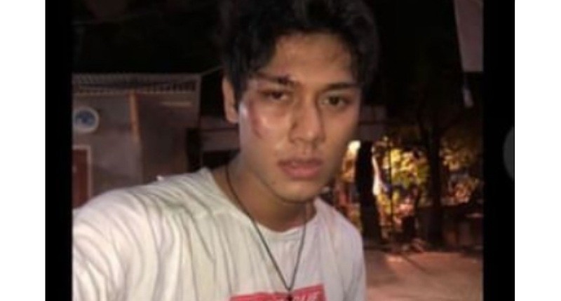 Viral, Rizky Billar Ternyata Pernah Dikeroyok Pacar Tamara Tyasmara