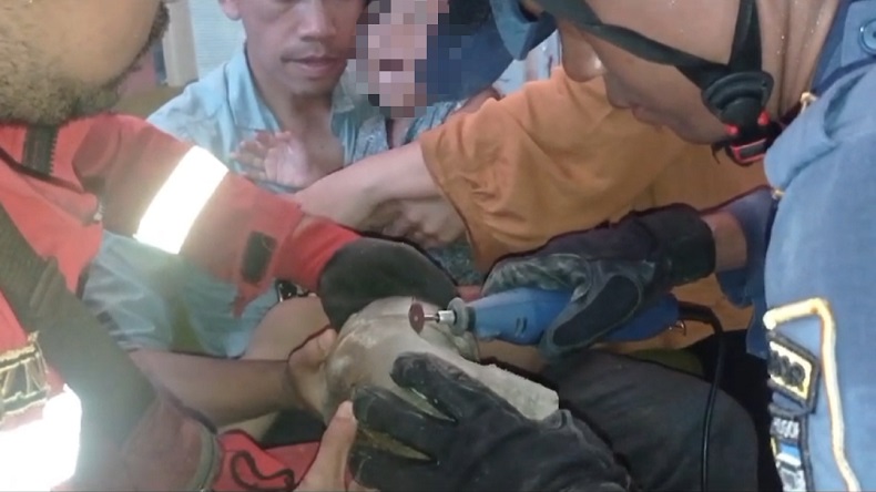 Kaki Bocah 4 Tahun di Bogor Terperosok ke Kloset saat BAB, Damkar Turun Tangan