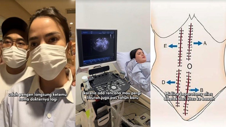 Idap Kanker Sakroma, Alice Norin Kehilangan Rahim hingga Alami Menopause Dini