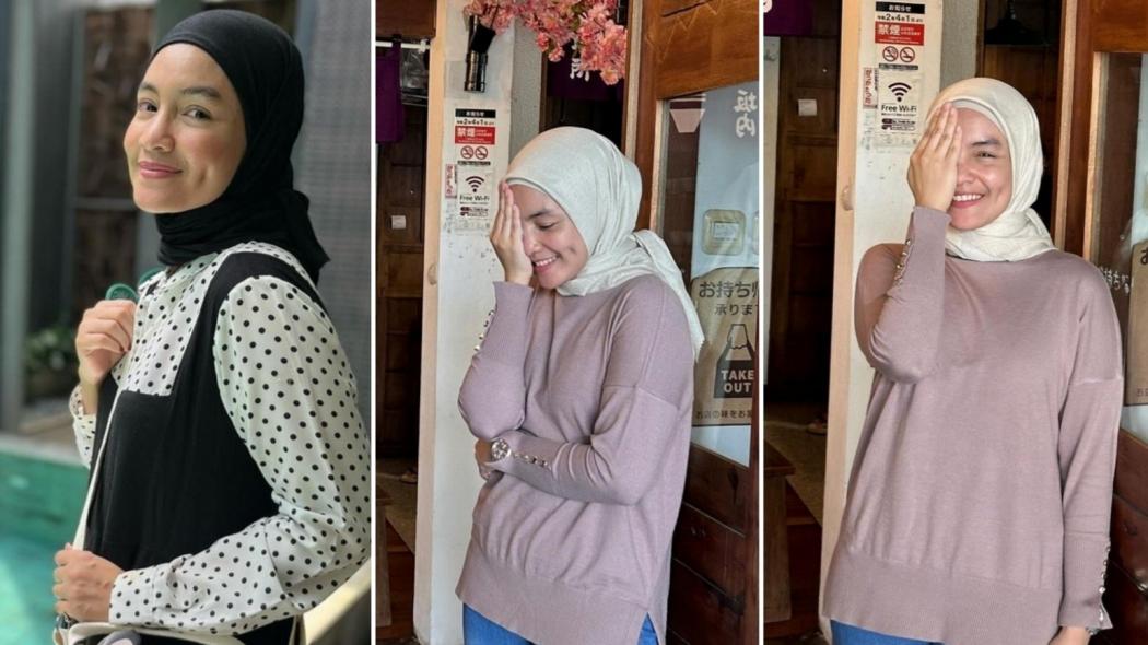 Ngeri! Kornea Mata Artis Cantik Ini Mengelupas, Kenapa? 