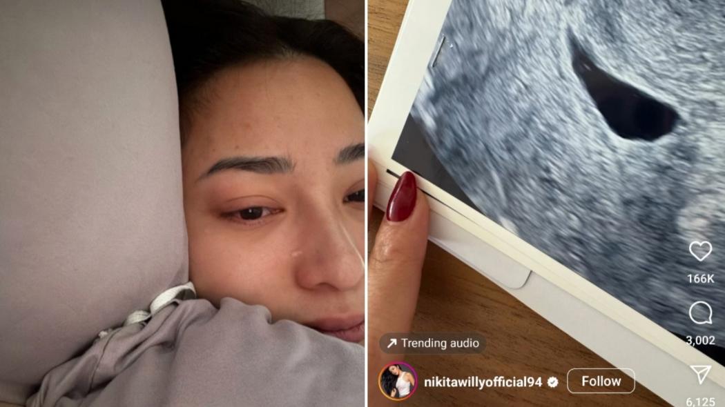 Nikita Willy Bagikan Kabar Duka, Alami Keguguran di Usia Kehamilan 7 Minggu