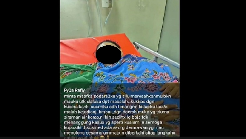 Pria di Makassar Siram Air Keras ke Wajah Mantan Istri, Kesal Ajakan Rujuk Ditolak