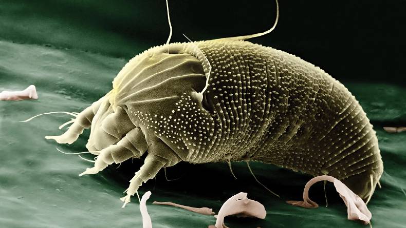 7 Cara Menghilangkan Tungau di Kasur, Tidur Jadi Nyenyak Bebas Gatal