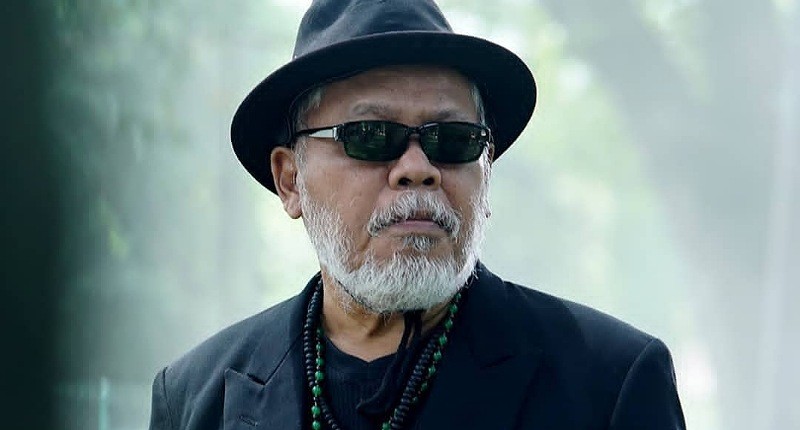 Penampakan Dorman Borisman yang Hari Ini Amputasi, Kaki Bengkak dan Membiru!