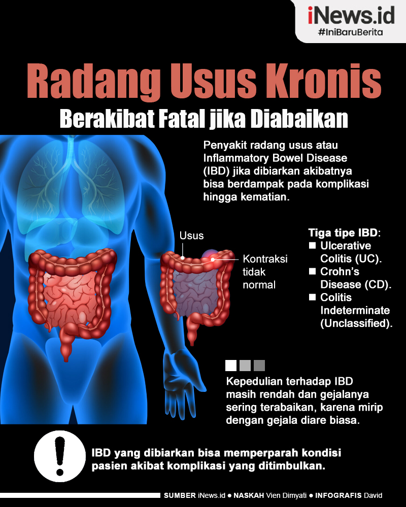 Infografis Radang Usus Kronis Bisa Berakibat Fatal jika Diabaikan