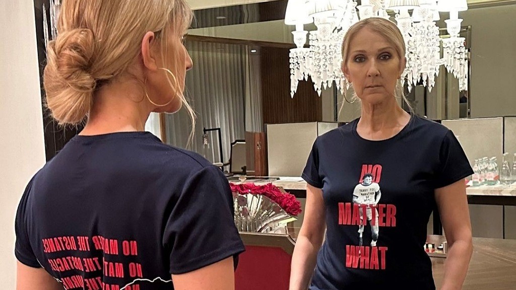 Celine Dion Idap Stiff Person Syndrome, Kenali Gejala dan Penyebabnya