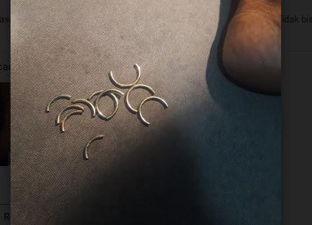 Pasang 5 Ring Tas di Kelamin, Kakek asal Jogja Kesakitan Minta Bantuan Damkar