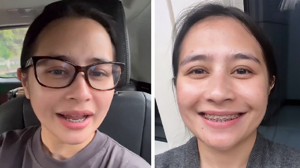 Belum Terbiasa, Prilly Latuconsina Kesulitan Pakai Behel: Gimana Sih Cara Nutup Bibirnya?