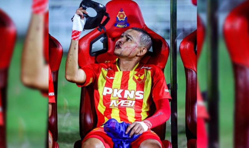 Pakai Topeng, Faisal Halim Winger Malaysia yang Disiram Air Keras Kembali Hadir di Lapangan