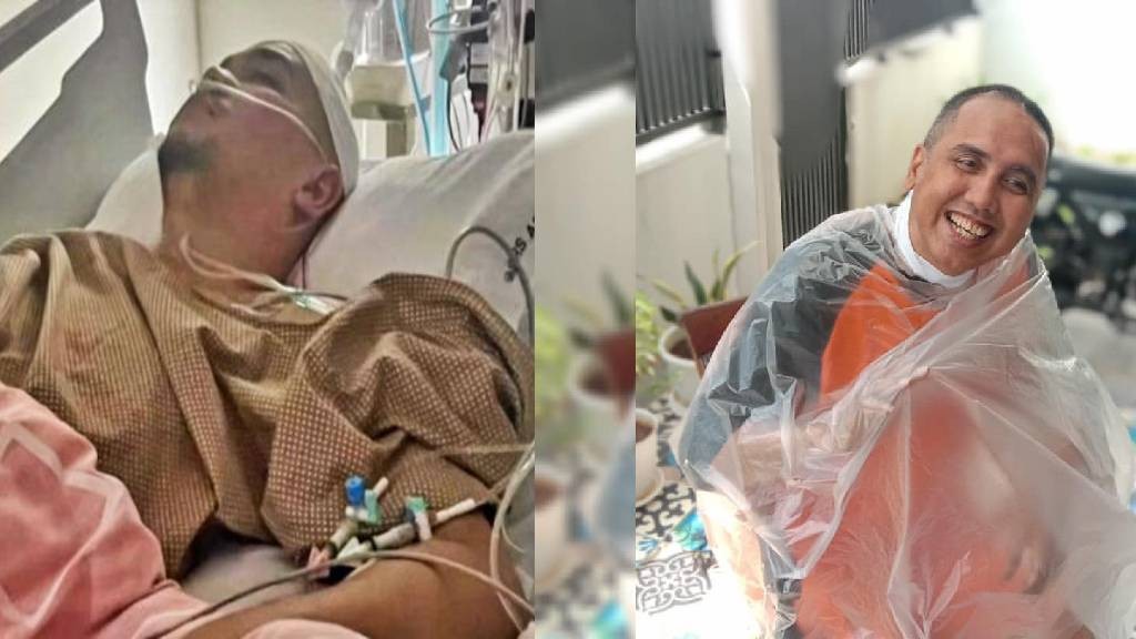 4 Artis Disebut Nyaris Meninggal, Ada yang 12 Tahun Berjuang Melawan Tumor Otak