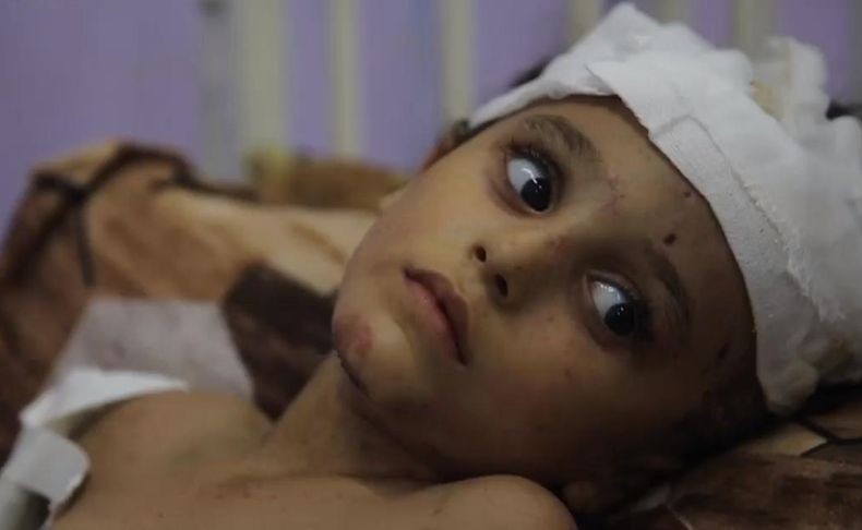 Kisah Dokter AS Tugas di Gaza Terpaksa Amputasi 80 Persen Pasien Anak akibat Bom Israel
