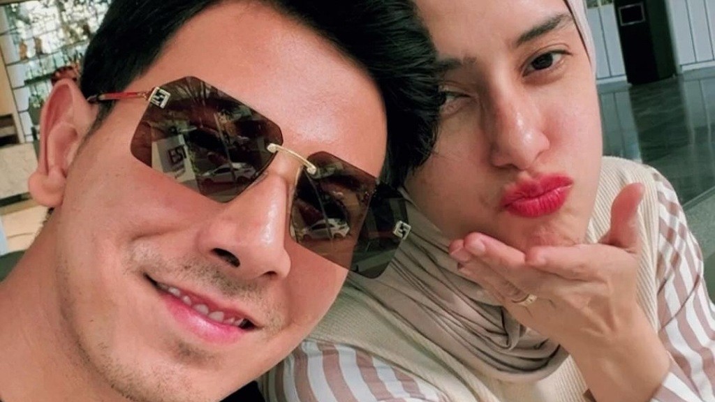 Masa Pemulihan, Sonny Septian Dilarang Konsumsi Makanan Tinggi Kolesterol