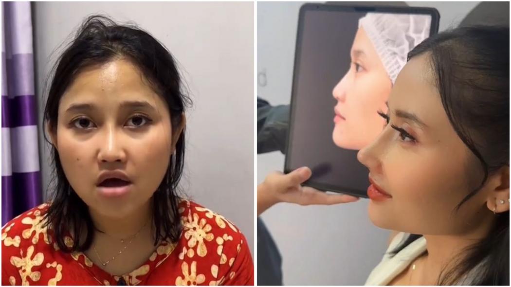 Glow Up! Diam-Diam Riyuka Bunga Mancungin Hidung, Netizen: Definisi Dendam Wanita Disakiti