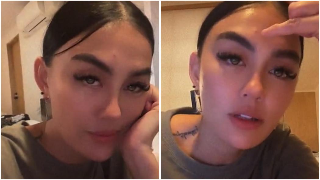 Respons Agnez Mo Balas Komentar Sinis Haters soal Jerawat di Dahi: Namanya Juga Orang 