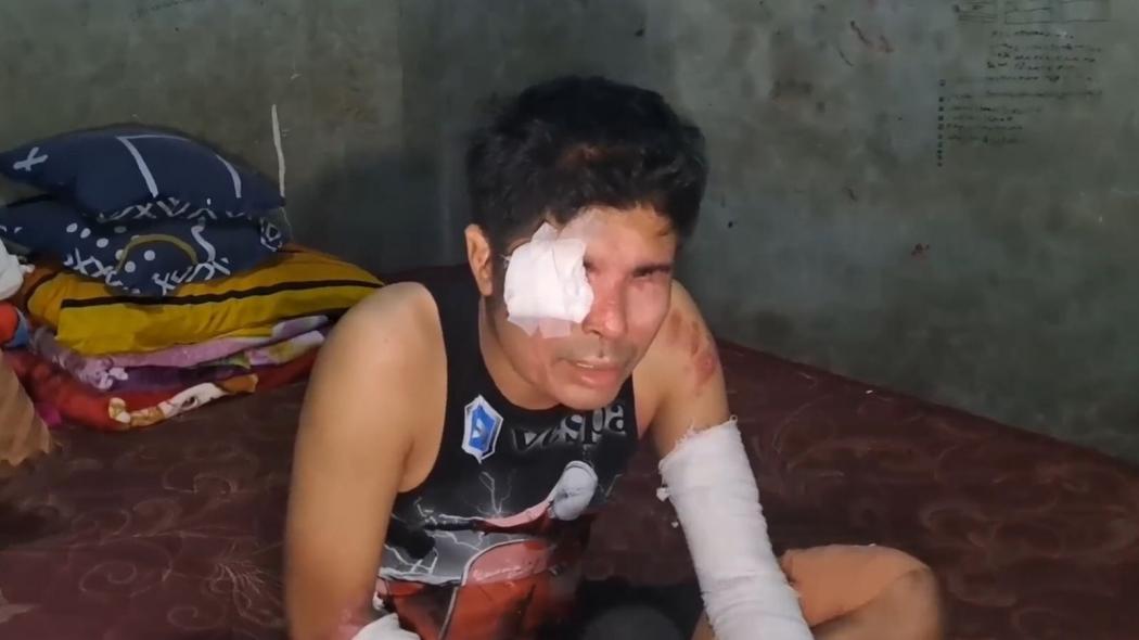 Viral Video Agus Salim Bisa Jalan Sendiri, Denny Sumargo Kaget