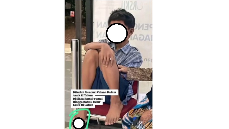 Sadis! Bocah di Boyolali Dianiaya Warga hingga Kuku Dicabut, Dituduh Curi Celana Dalam