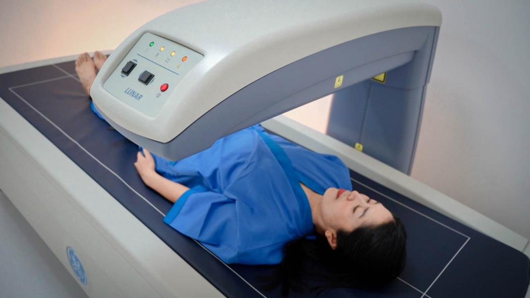 Cara Deteksi Osteoporosis di Usia Muda, Lengkap dengan Pencegahannya