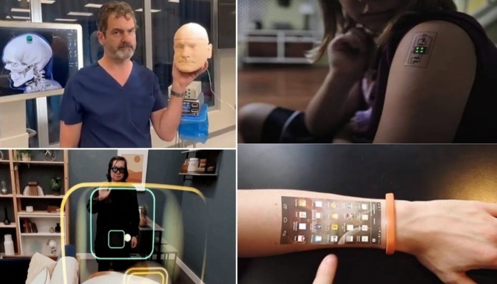 3 Teknologi Pengganti Smartphone, Nomor 2 Paling Ekstrem Ditanam di Otak Manusia