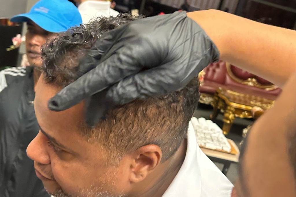 Kondisi Terkini Pelatih Persik usai Jadi Korban Pelemparan Batu di Kanjuruhan